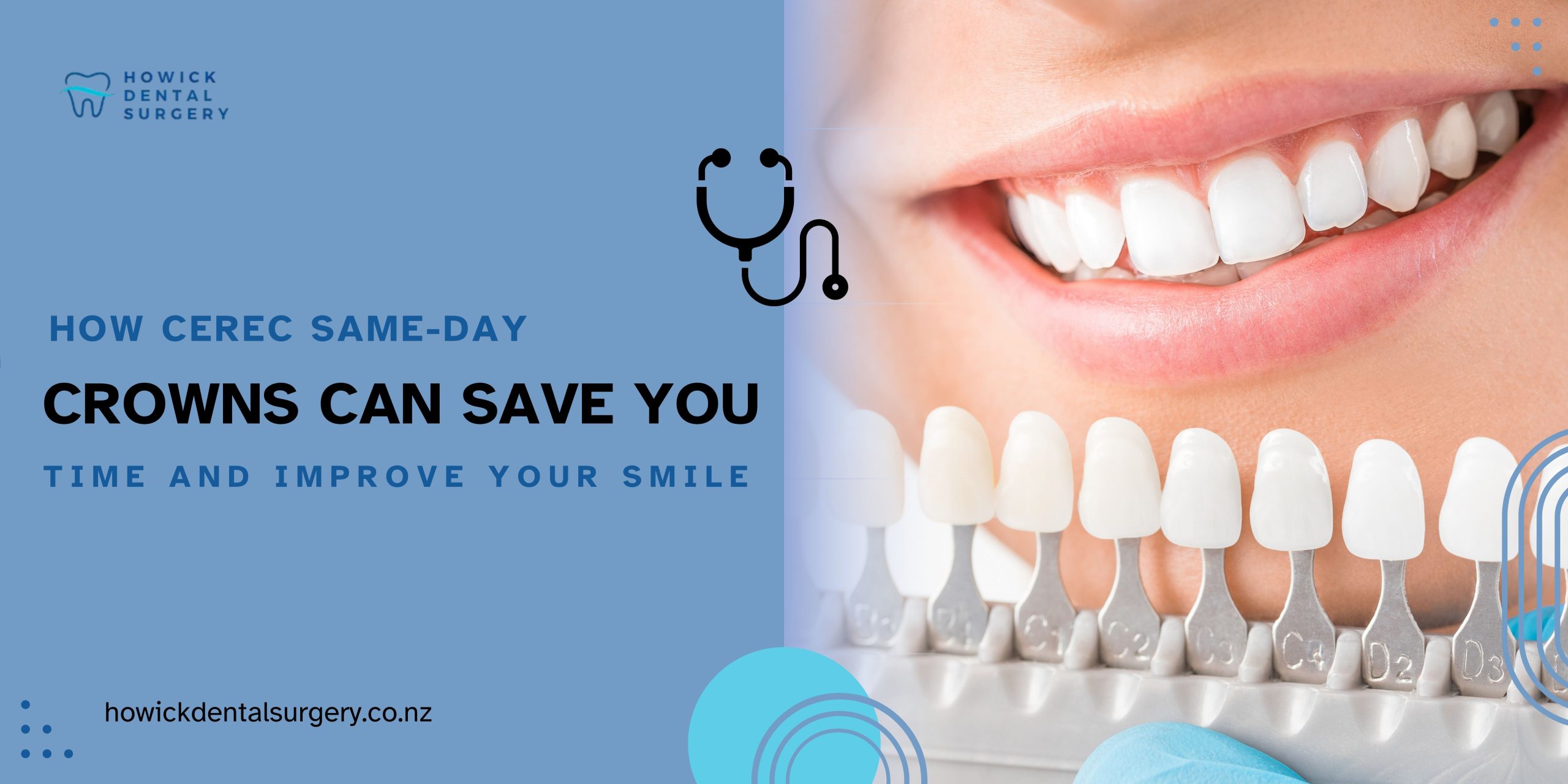 How CEREC Same-Day Crowns Can Save You Time and Improve Your Smile