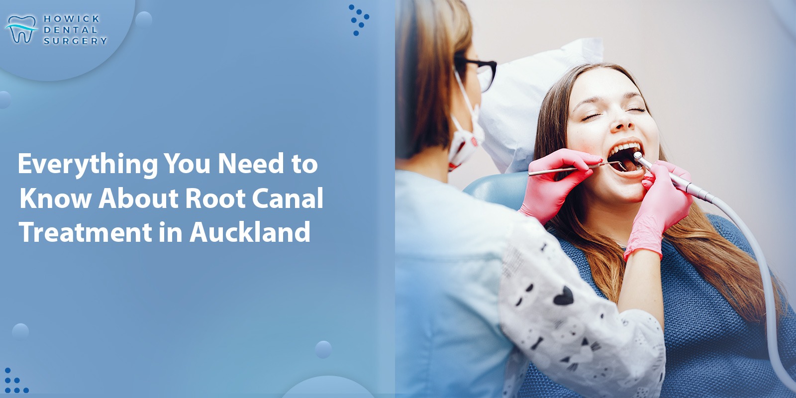 Everything You Need to Know About Root Canal Treatment in Auckland
