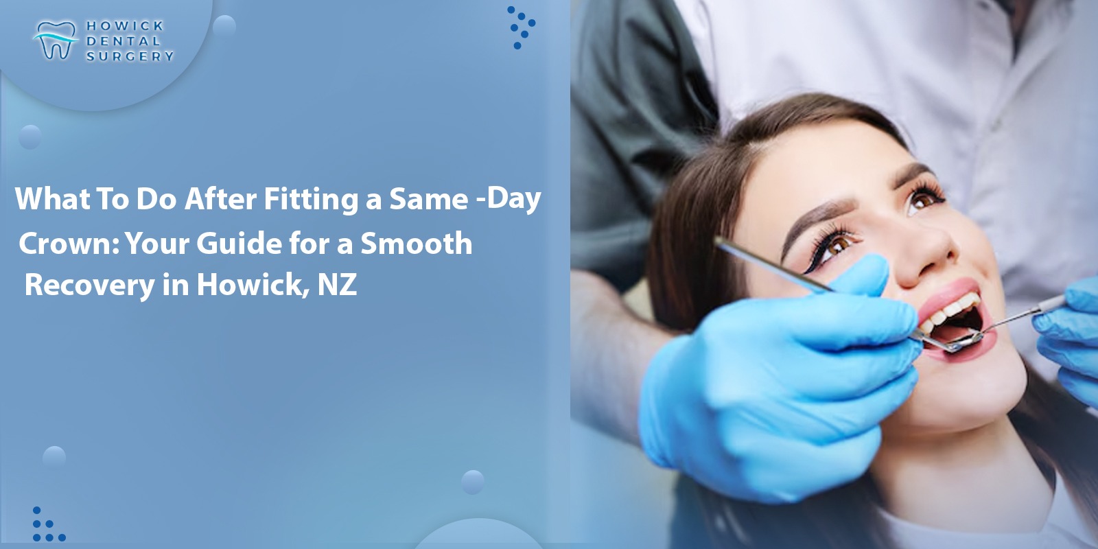 What To Do After Fitting a Same-Day Crown: Your Guide for a Smooth Recovery in Howick, NZ
