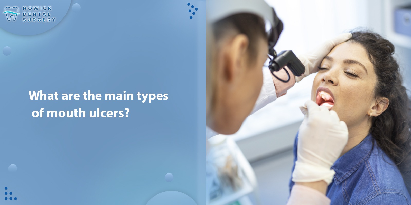 What are the main types of mouth ulcers?