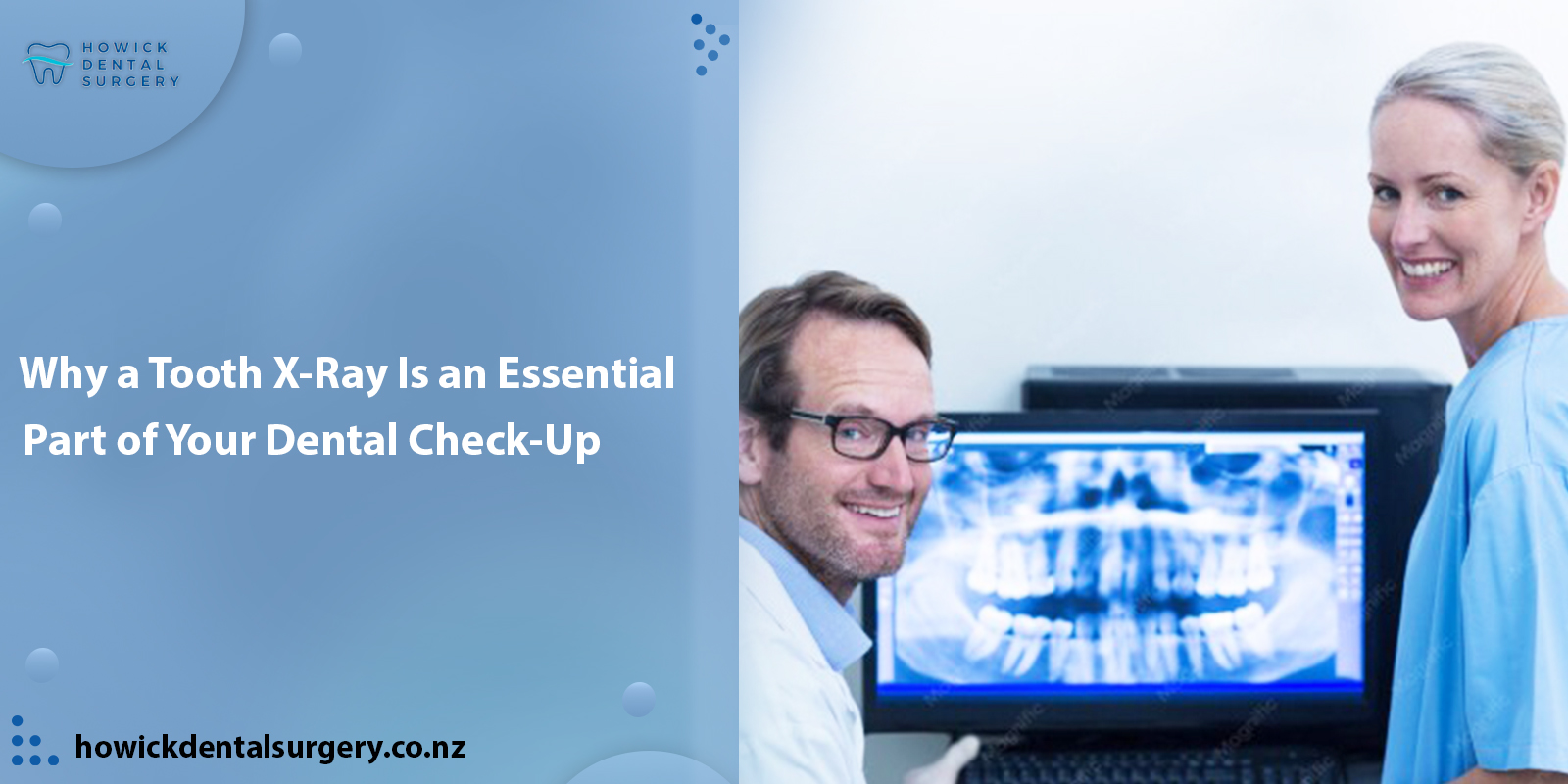 Why a Tooth X-Ray Is an Essential Part of Your Dental Check-Up