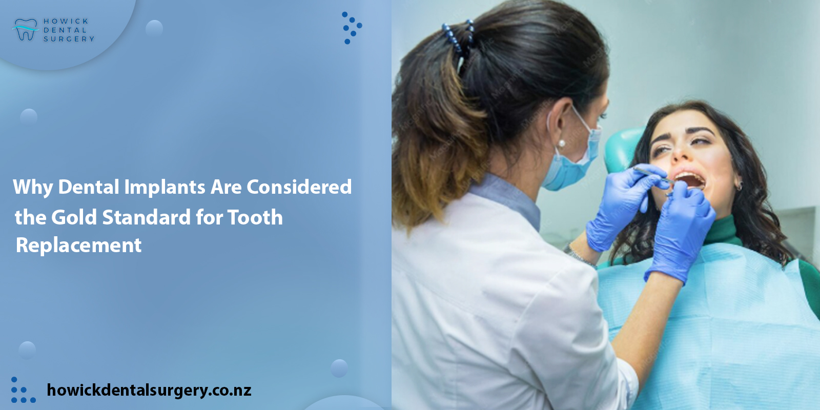 Why Dental Implants Are Considered the Gold Standard for Tooth Replacement
