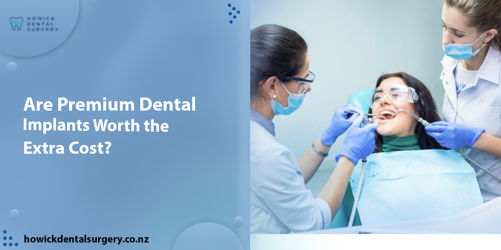 Are Premium Dental Implants Worth the Extra Cost?